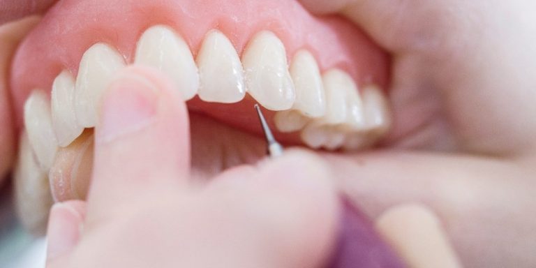 PRÓTESIS DENTAL