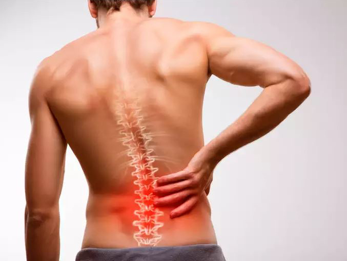 Espondilitis anquilosante