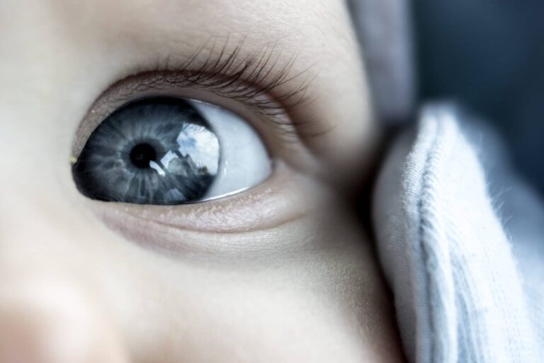 Retinopatía del prematuro