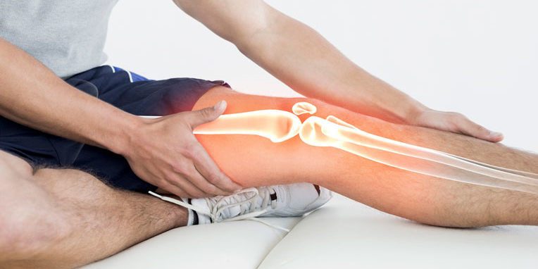 TENDINITIS ANSERINA: El dolor en las rodillas que no suele diagnosticarse oportunamente