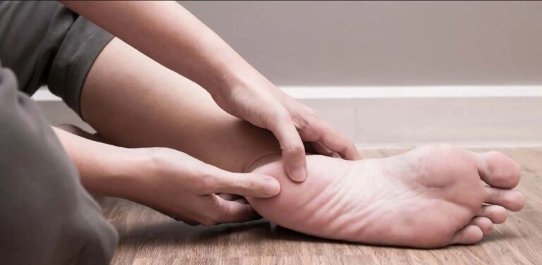 FASCITIS PLANTAR