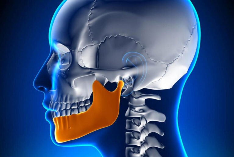 ¿Qué es la Disfunción Cráneo-cérvico-mandibular?