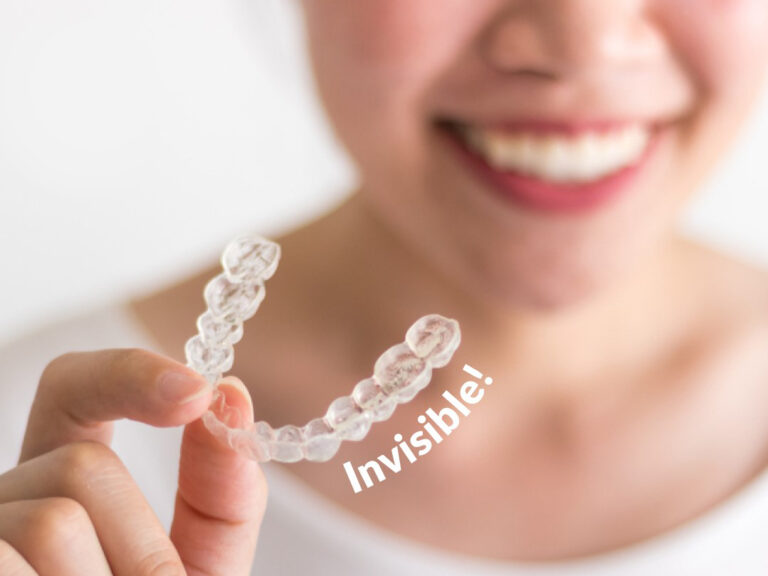 El camino a una sonrisa perfecta: ¿Cómo funciona el tratamiento invisible paso a paso?